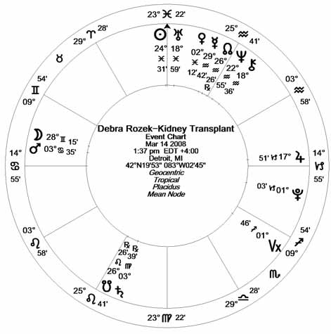 Debra Rozek - Kidney Transplant